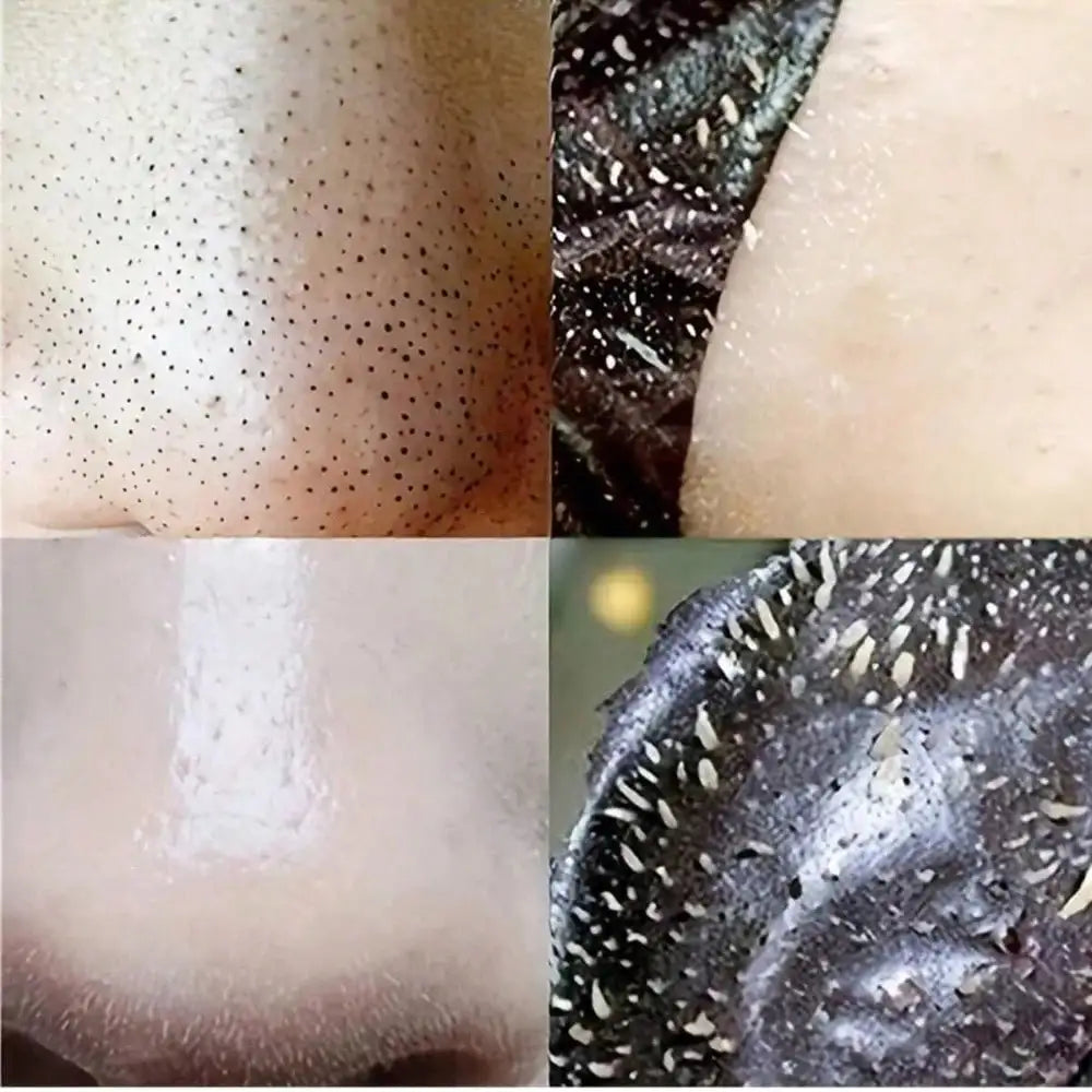 Blackhead Remover Nose Strips, Deep Cleanse And Refresh Your Skin, Instant Pore Unclogging, Nose Patch